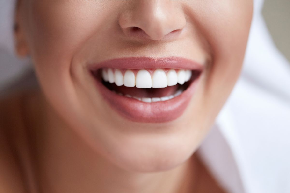 4 benefits of zoom teeth whitening