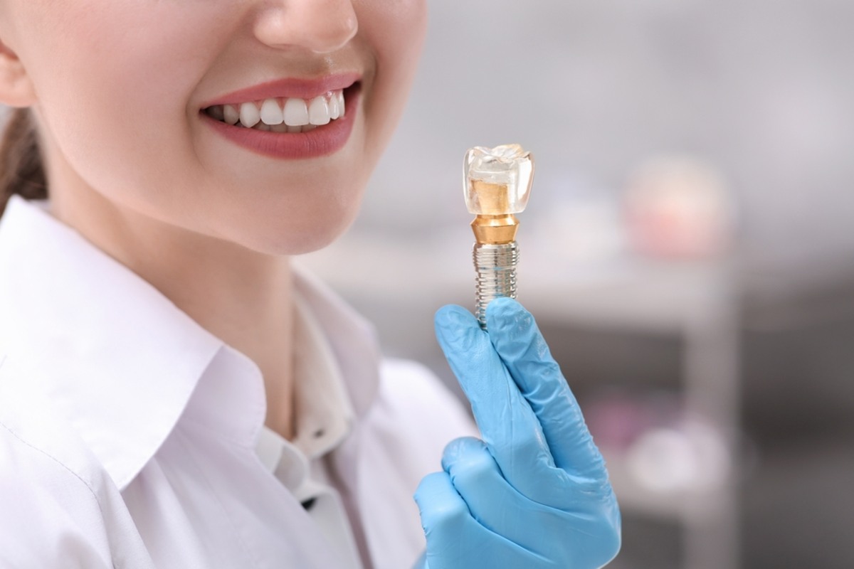 common myths about dental implants debunked