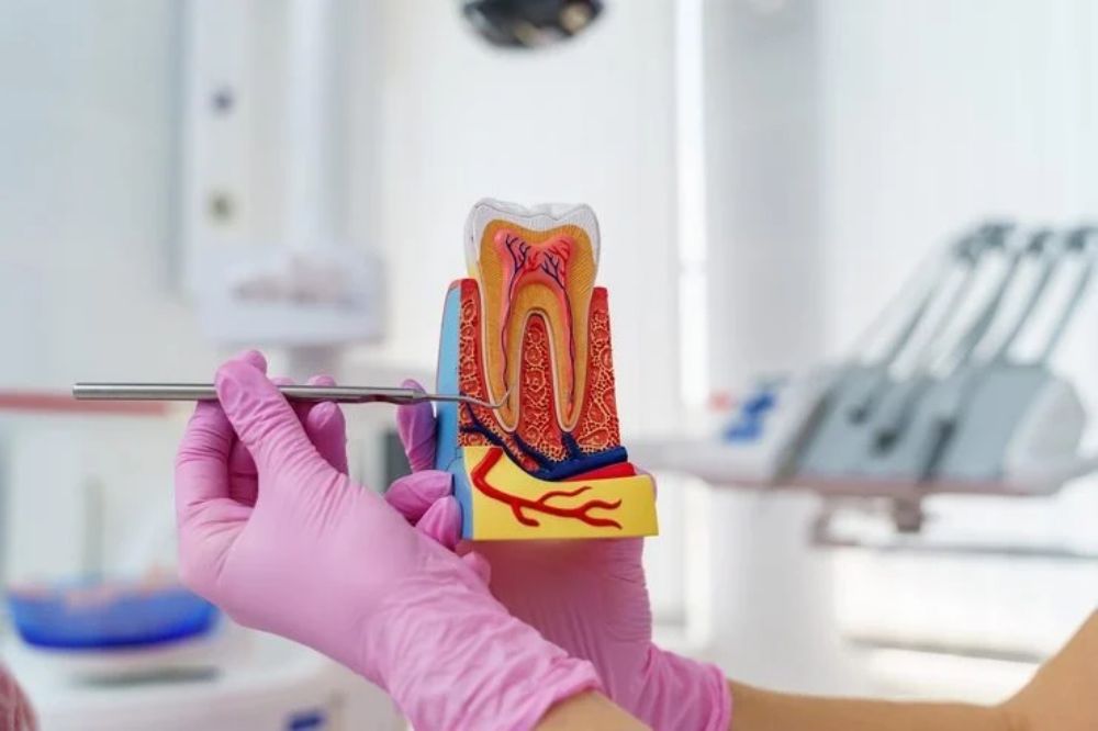 Is a Root Canal Really Painful?